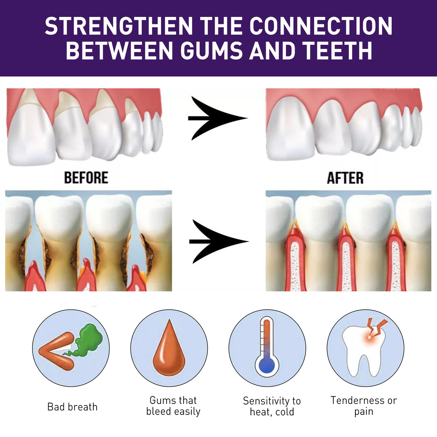 Teeth Whitening Pen & Gum Care Serum - Fast Stain Removal, Enamel Safe (3ml)
