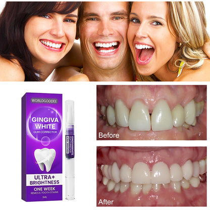 Teeth Whitening Pen & Gum Care Serum - Fast Stain Removal, Enamel Safe (3ml)