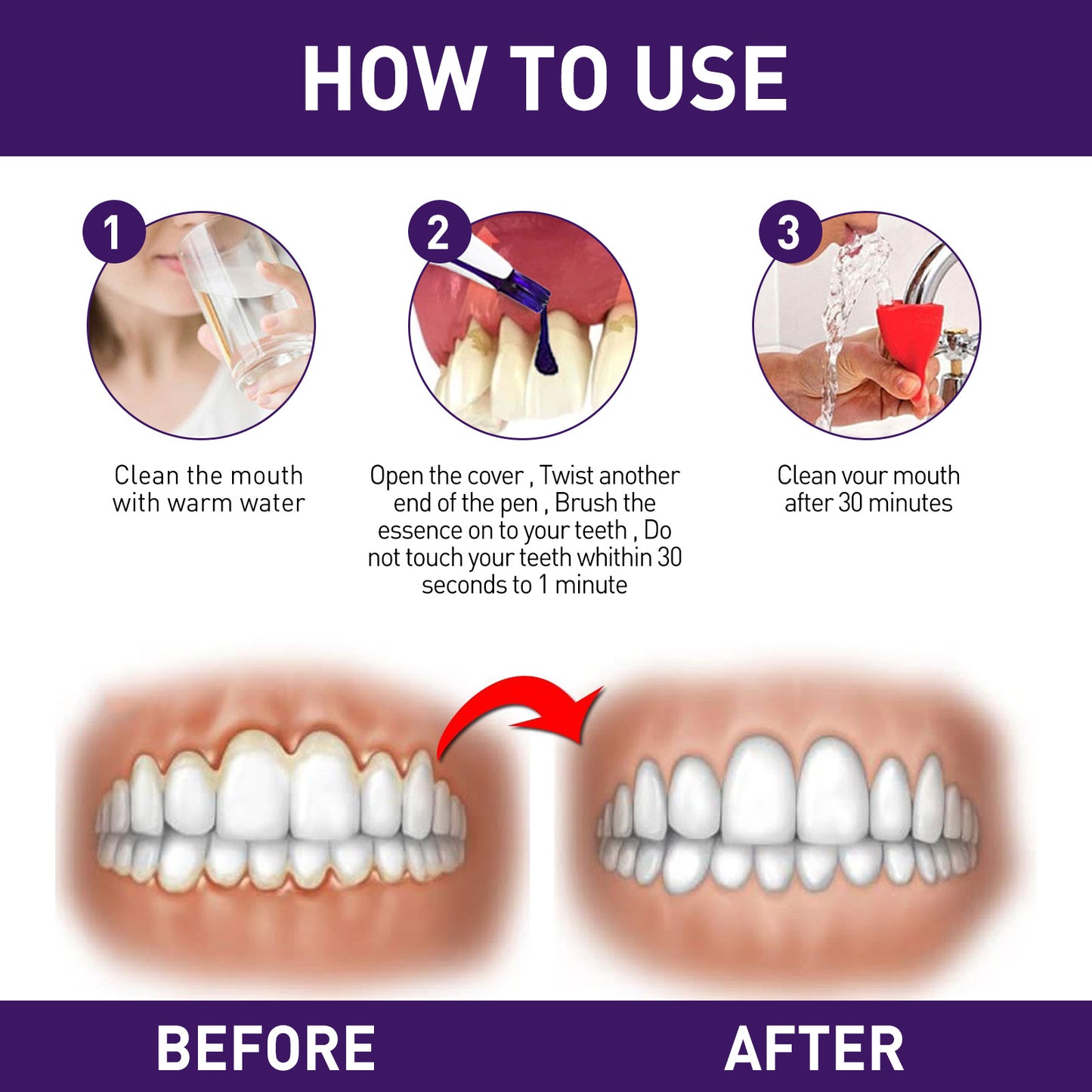 Teeth Whitening Pen & Gum Care Serum - Fast Stain Removal, Enamel Safe (3ml)