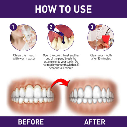 Teeth Whitening Pen & Gum Care Serum - Fast Stain Removal, Enamel Safe (3ml)